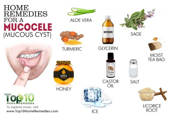 home-remedies-for-quick-relief-for-mucocele