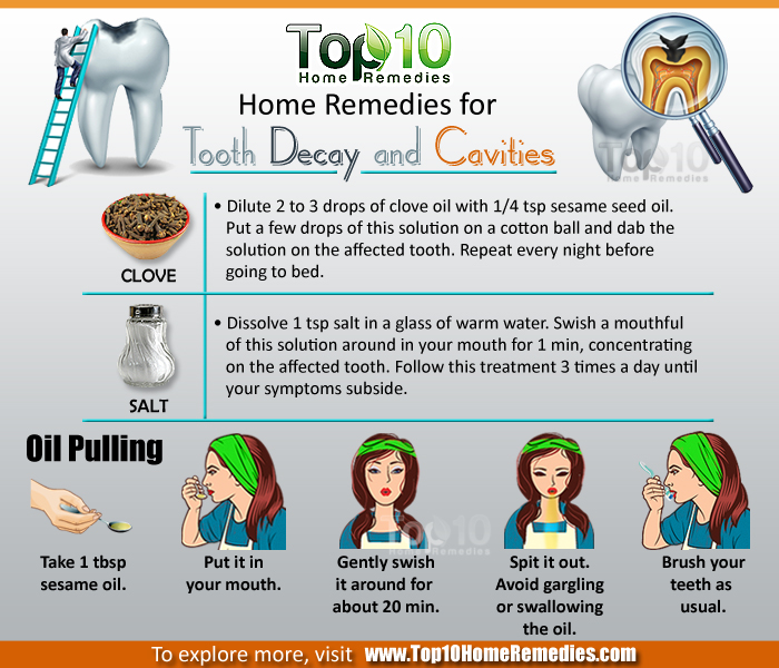 How to Cure Tooth Decay Home&nbsp;Remedies